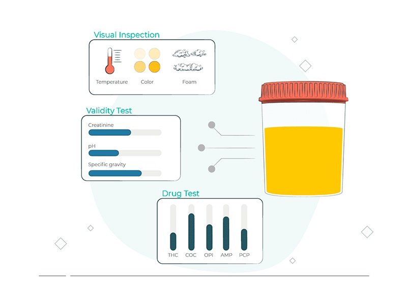 urine check stages